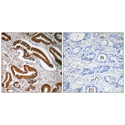 Menin (MEN1) Antibody
