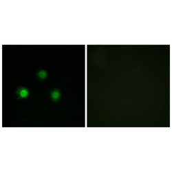 DNA Mismatch Repair Protein Msh2 (MSH2) Antibody