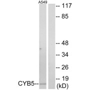 Western blot analysis of extracts from A549 cells, using CYB5 antibody.
