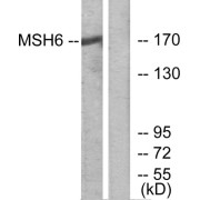 Western blot analysis of extracts from HUVEC cells, using MSH6 antibody.