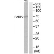 Western blot analysis of extracts from K562 and HuvEc cells, using PARP2 antibody.