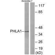 Western blot analysis of extracts from RAW264.7 cells, using PHLA1 antibody.