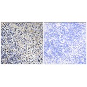 Immunohistochemistry analysis of paraffin-embedded human thymus gland tissue using TPIP1 antibody.