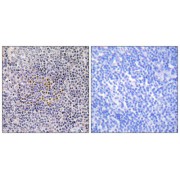 Immunohistochemistry analysis of paraffin-embedded human tonsil tissue using XRCC3 antibody.