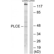 Western blot analysis of extracts from LOVO cells, using AGPAT5 antibody.