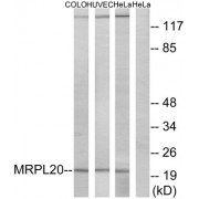Western blot analysis of extracts from COLO cells, HUVEC cells and HeLa cells, using MRPL20 antibody.
