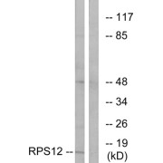Western blot analysis of extracts from COLO cells, using RPS12 antibody.