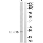 Western blot analysis of extracts from Jurkat cells, using RPS15 antibody.