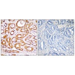 Ribosomal Protein S19 (RPS19) Antibody