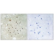 Immunohistochemistry analysis of paraffin-embedded human brain tissue using RPS19BP1 antibody.