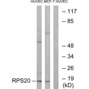 Western blot analysis of extracts from HUVEC cells and MCF-7 cells, using RPS20 antibody.