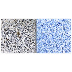 40S Ribosomal Protein S3 (RPS3) Antibody