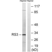 Western blot analysis of extracts from HepG2 cells, using RPS3 antibody.