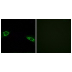 Ribosomal Protein S4, Y-Linked 1 (RPS4Y1) Antibody