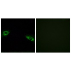 Small Ribosomal Subunit Protein eS4, Y Isoform 1 (RPS4Y1) Antibody