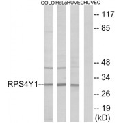 Western blot analysis of extracts from COLO cells, HeLa cells and HUVEC cells, using RPS4Y1 antibody. The lane on the extreme right is treated with a synthetic peptide.