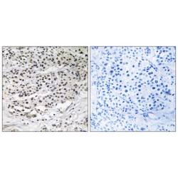 Centrosomal Protein Of 131 Kda (CEP131) Antibody