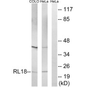 Western blot analysis of extracts from COLO cells and HeLa cells, using RPL18 antibody.