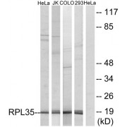 Western blot analysis of extracts from HeLa cells, Jurkat cells, COLO cells and 293 cells, using RPL35 antibody.