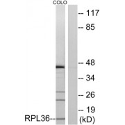 Western blot analysis of extracts from COLO cells, using RPL36 antibody.