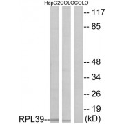 Western blot analysis of extracts from HepG2 cells and COLO cells, using RPL39 antibody.