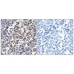 6-Phosphogluconolactonase (PGLS) Antibody