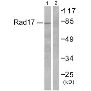 Western blot analysis of extracts from RAW264.7 cells, using ABHD14A antibody.