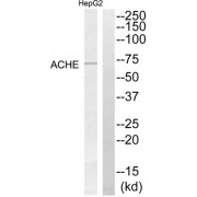 Western blot analysis of extracts from HepG2 cells, using ACHE antibody.