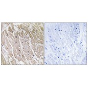 Immunohistochemistry analysis of paraffin-embedded human heart tissue using ACAD10 antibody.