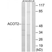 Western blot analysis of extracts from Jurkat cells and HuvEc cells, using ACOT2 antibody.