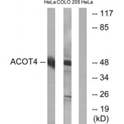 Western blot analysis of extracts from HeLa cells and COLO cells, using ACOT4 antibody.