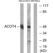 Western blot analysis of extracts from HeLa cells and COLO cells, using ACOT4 antibody.