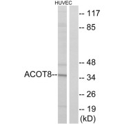 Western blot analysis of extracts from HUVEC cells, using ACOT8 antibody.