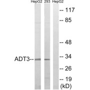 Western blot analysis of extracts from HepG2 cells and 293 cells, using SLC25A6 antibody.