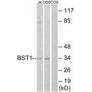 Western blot analysis of extracts from Jurkat cells and COS cells, using BST1 antibody.