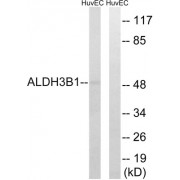 Western blot analysis of extracts from HuvEc cells, using ALDH3B1 antibody.
