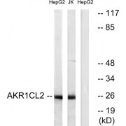 Western blot analysis of extracts from HepG2 cells and Jurkat cells, using AKR1CL2 antibody.