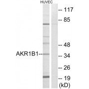 Western blot analysis of extracts from HUVEC cells, using AKR1B1 antibody.
