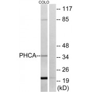 Western blot analysis of extracts from COLO cells, using Alkaline Ceramidase 3 Antibody.