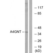 Western blot analysis of extracts from K562 cells, using A4GNT antibody.