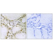 Immunohistochemistry analysis of paraffin-embedded human thyroid gland tissue using AMPD1 antibody.