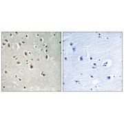 abx014192