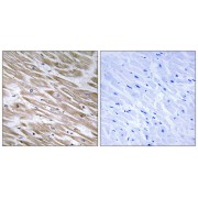 Immunohistochemistry analysis of paraffin-embedded human heart tissue using KANK2 antibody.
