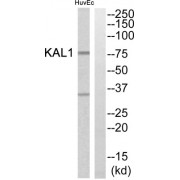 Western blot analysis of extracts from HuvEc cells, using KAL1 antibody.