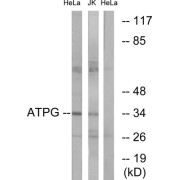 Western blot analysis of extracts from HeLa cells and Jurkat cells, using ATPG antibody.