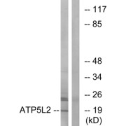 Western blot analysis of extracts from A549 cells, using ATP5L2 antibody.