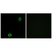 Immunofluorescence analysis of A549 cells, using ABCA13 antibody.