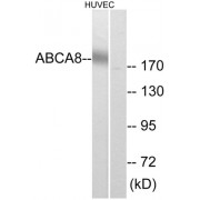 Western blot analysis of extracts from HUVEC cells, using ABCA8 antibody.
