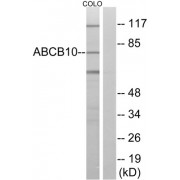 Western blot analysis of extracts from COLO cells, using ABCB10 antibody.