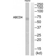 Western blot analysis of extracts from HepG2 cells, using ABCD4 antibody.